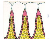 Oral Prophylaxis