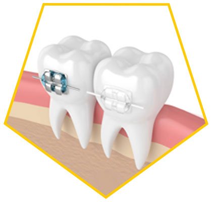 Orthodontics